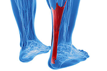 Achilles tendon treatment in the  Los Angeles County, CA: Los Angeles (Long Beach, Glendale, Torrance, Pasadena, Santa Monica), Huntington Park (Downey, Norwalk, Compton, lynwood) & Reseda (Santa Clarita, Thousand Oaks, Burbank) areas