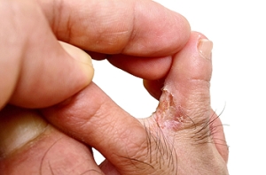 Athlete’s Foot and Nail Salons