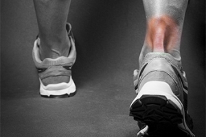 What Can Cause an Achilles Tendon Injury?
